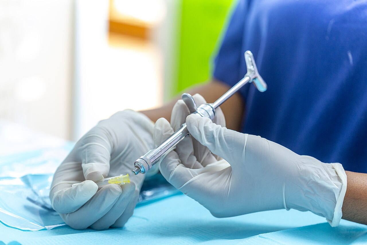 Local anesthesia