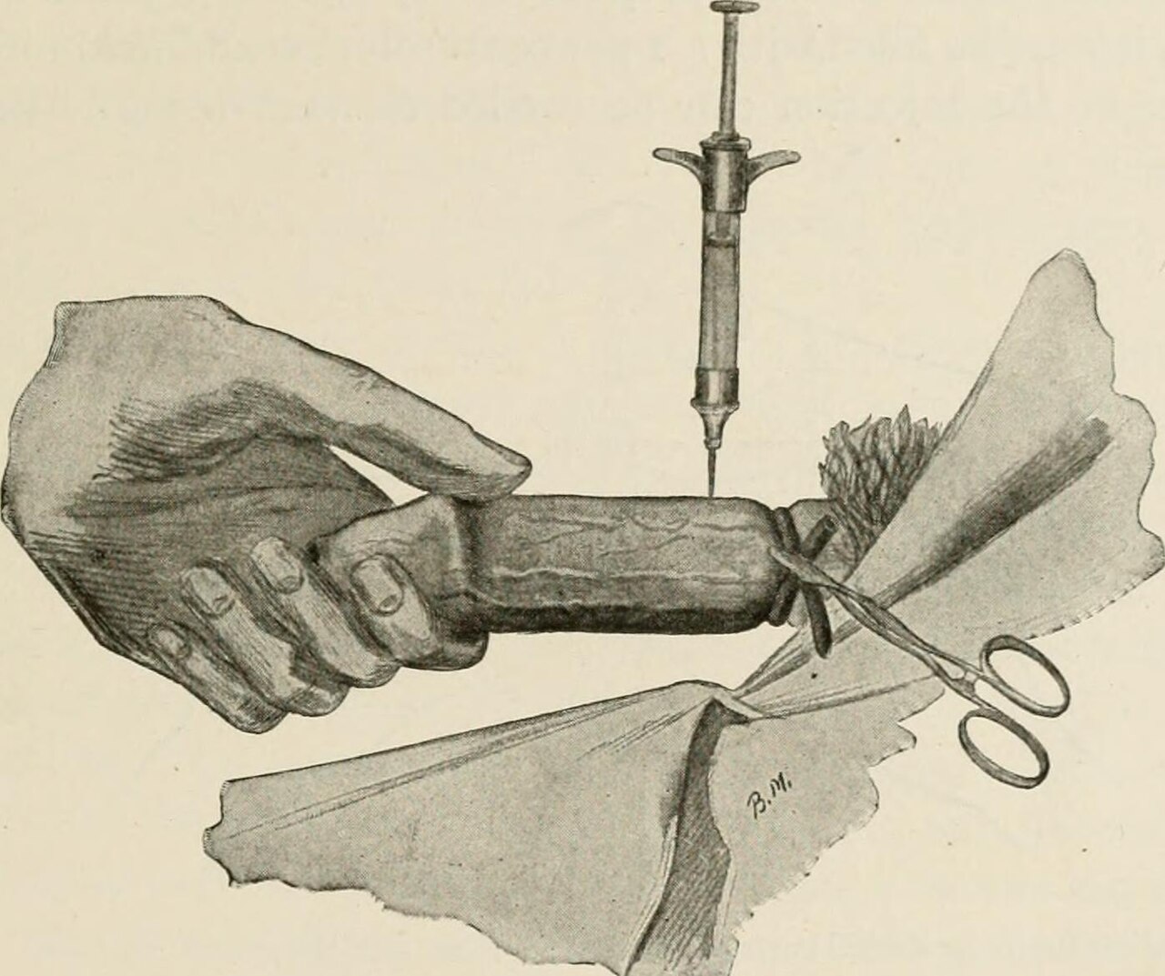 Local anesthetic